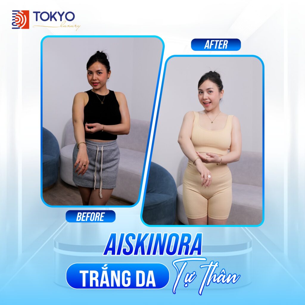 trắng da aiskinora