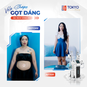 giảm béo công nghệ cao có tốt không