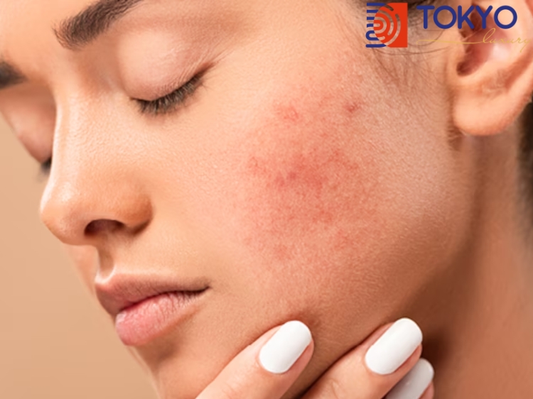 da mặt bị cháy nắng làm sao để trắng lại