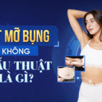 Hút Mỡ Bụng Không Phẫu Thuật Là Gì?