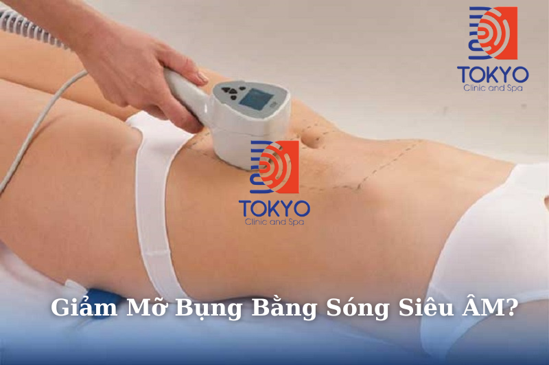 Giảm mỡ bụng bằng sóng siêu âm