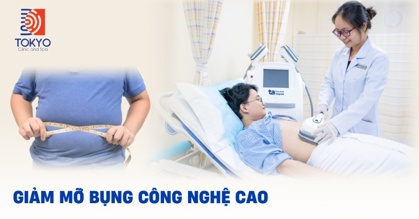 giảm mỡ bụng bằng công nghệ cao