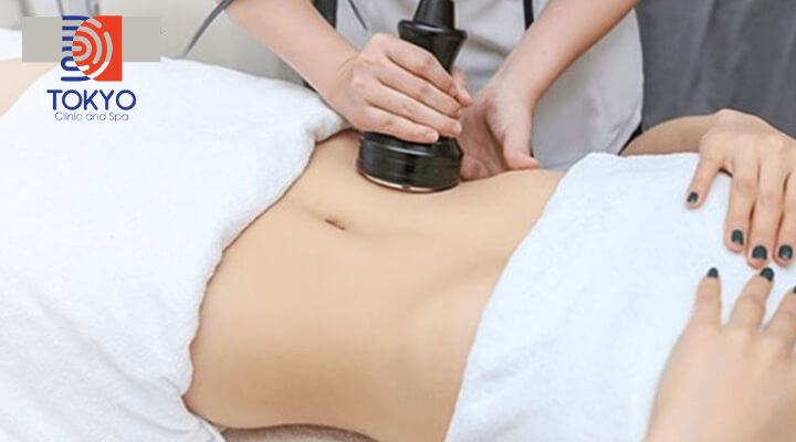Các Công Nghệ Hút Mỡ Bụng Không Phẫu Thuật Phổ Biến Hiện Nay