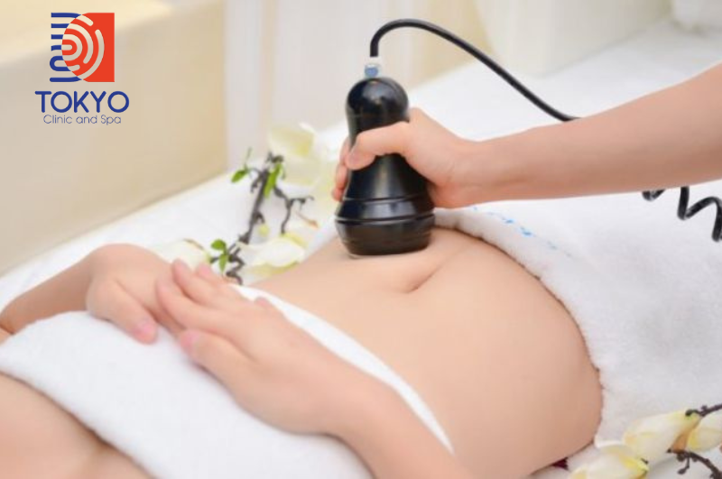 Giảm mỡ bụng bằng sóng siêu âm, đặc biệt là công nghệ HIFU, được đánh giá là an toàn cao khi được thực hiện đúng cách tại các cơ sở uy tín.