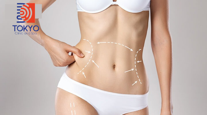 Công nghệ sóng tần số vô tuyến (Radiofrequency - RF)