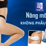 Nâng mông không phẫu thuật là gì?