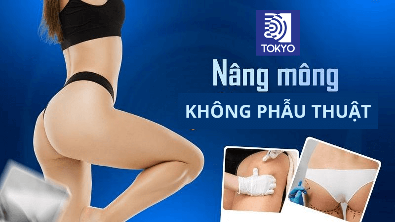 Nâng mông không phẫu thuật là gì?