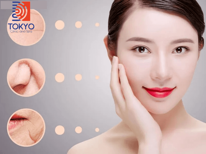 Trẻ hóa da mặt bằng công nghệ Thermage FLX