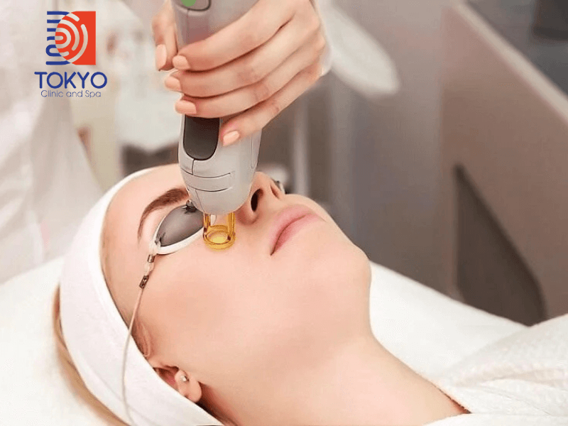 Các Công Nghệ Trẻ Hóa Da Mặt Tốt Nhất Hiện Nay