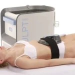 Công nghệ giảm mỡ bằng sóng điện từ cường độ cao - Công nghệ EMSculpt