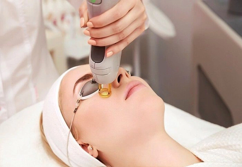 Trẻ Hóa Da Bằng Laser Có Tốt Không?