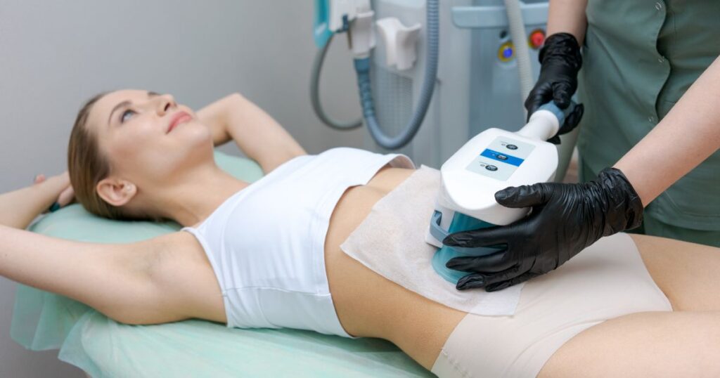 CoolSculpting