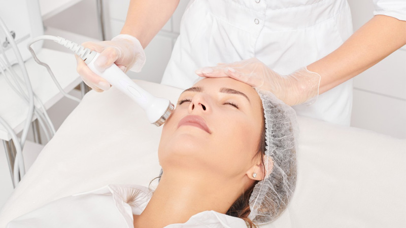 Điều trị nám bằng laser có tốt không?
