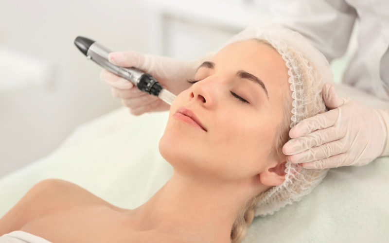 Bắn Laser Trị Tàn Nhang Có Tốt Không?