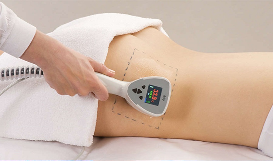 Công nghệ giảm béo Exilis giá bao nhiêu?