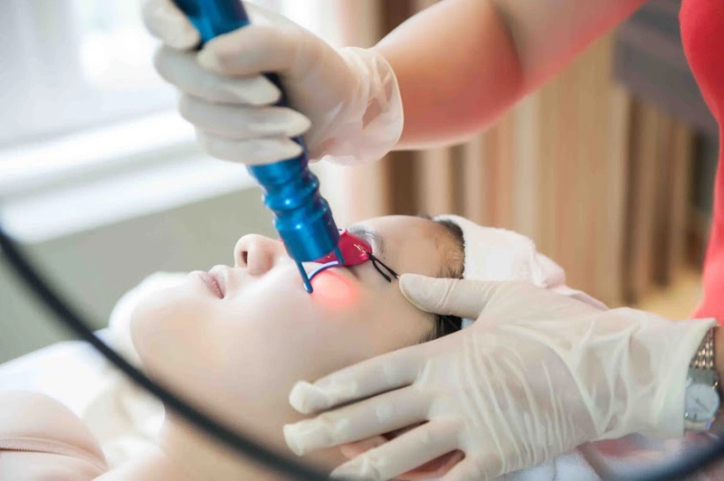 Các Phương Pháp Laser Trẻ Hóa Da Phổ Biến