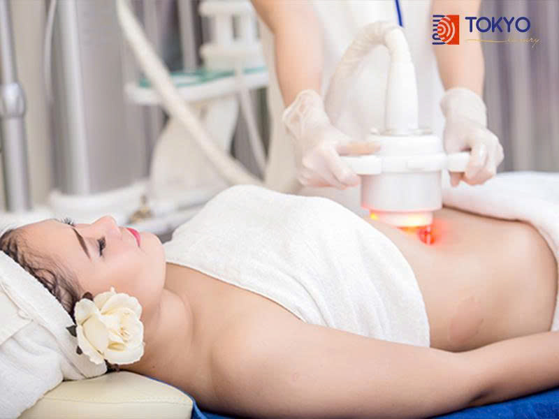 Giảm cân sau sinh mổ