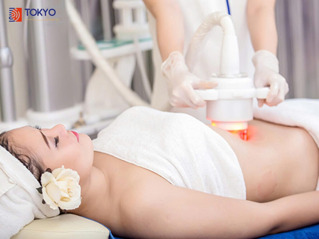 Giảm Cân Sau Sinh An Toàn – Hiệu Quả